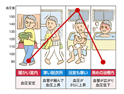 ヒートショックとは？